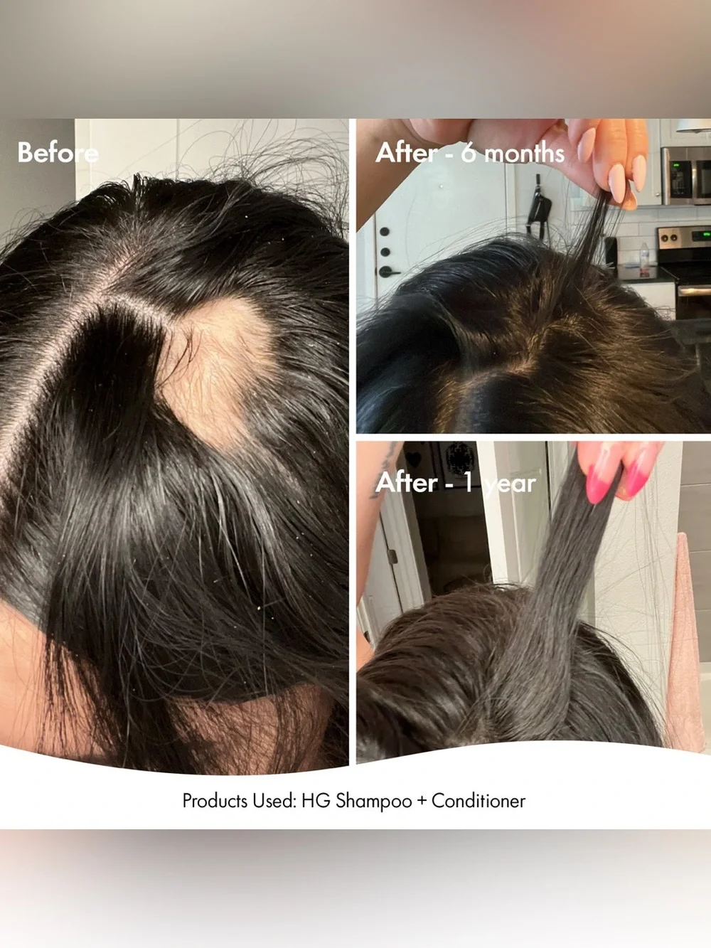 Bondi Boost Grow Getter Hair Care Set~Rosemary For Thinning/Damaged Hair~Sealed